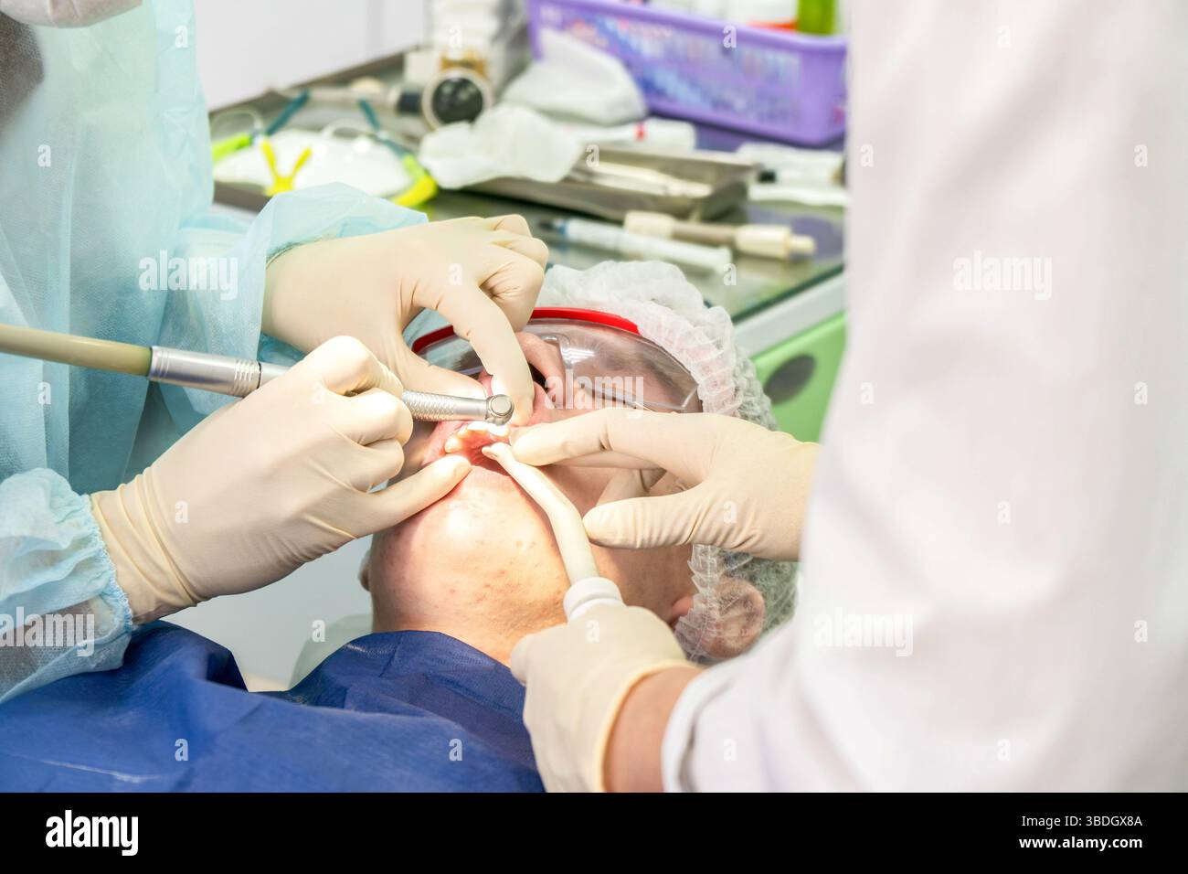 Un professionnel dentaire effectue une procédure de nettoyage sur un patient pour éliminer la plaque dentaire, assurant la santé dentaire et la blancheur des dents Banque D'Images