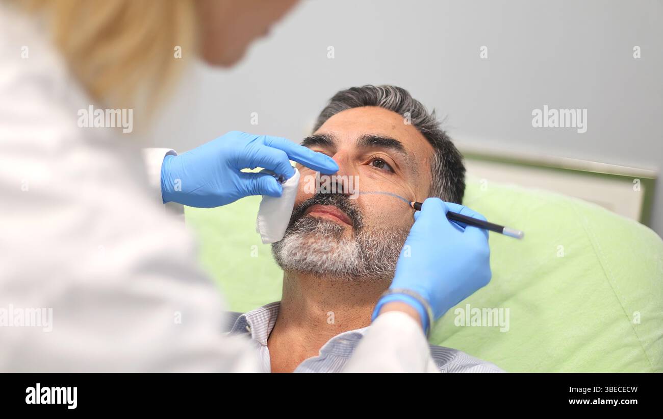 Médecin marquant le visage d'un patient masculin avec un stylo, se préparant à une procédure cosmétique dans une clinique de beauté, patient allongé. Banque D'Images