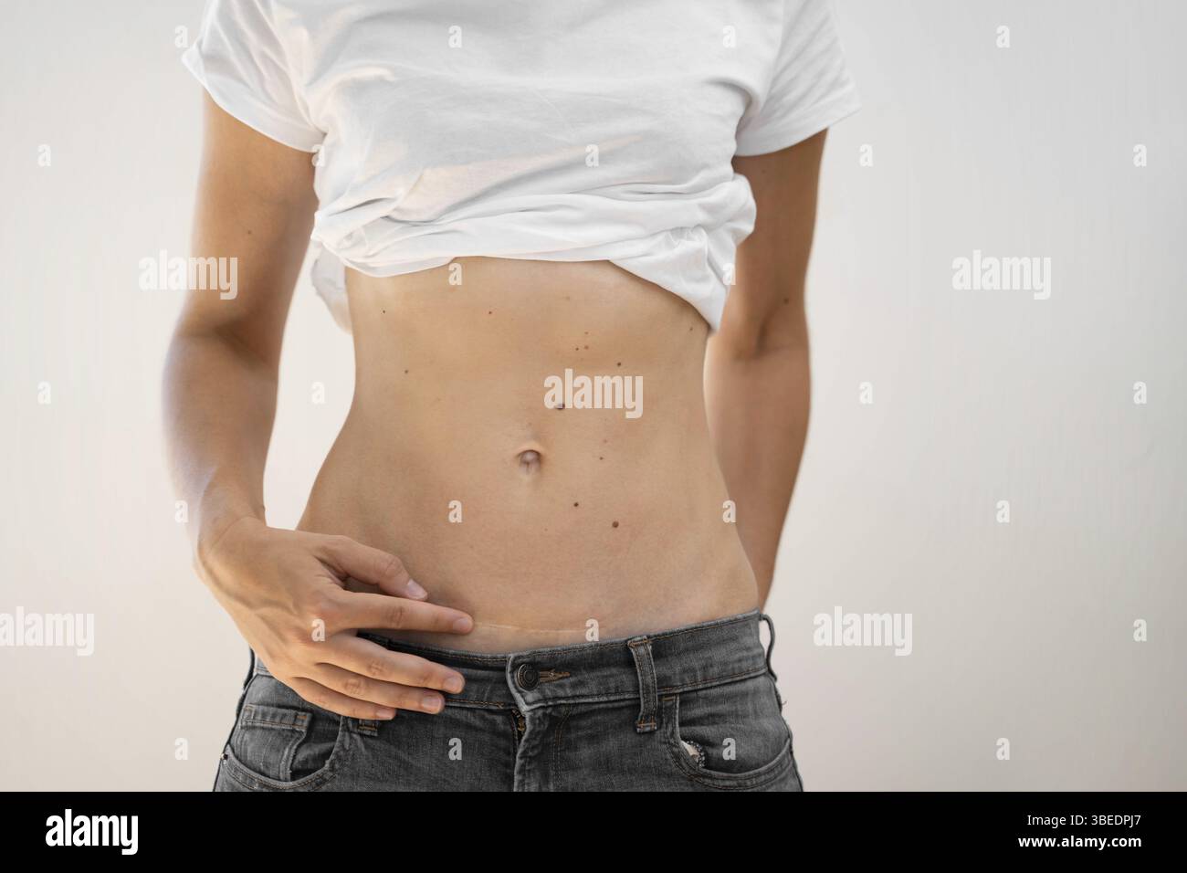 Fit femme sportive avec abs et cicatrice de césarienne. Guérison du post-partum. Banque D'Images