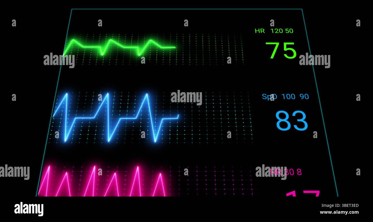 Image de l'électrocardiographe sur fond noir Banque D'Images