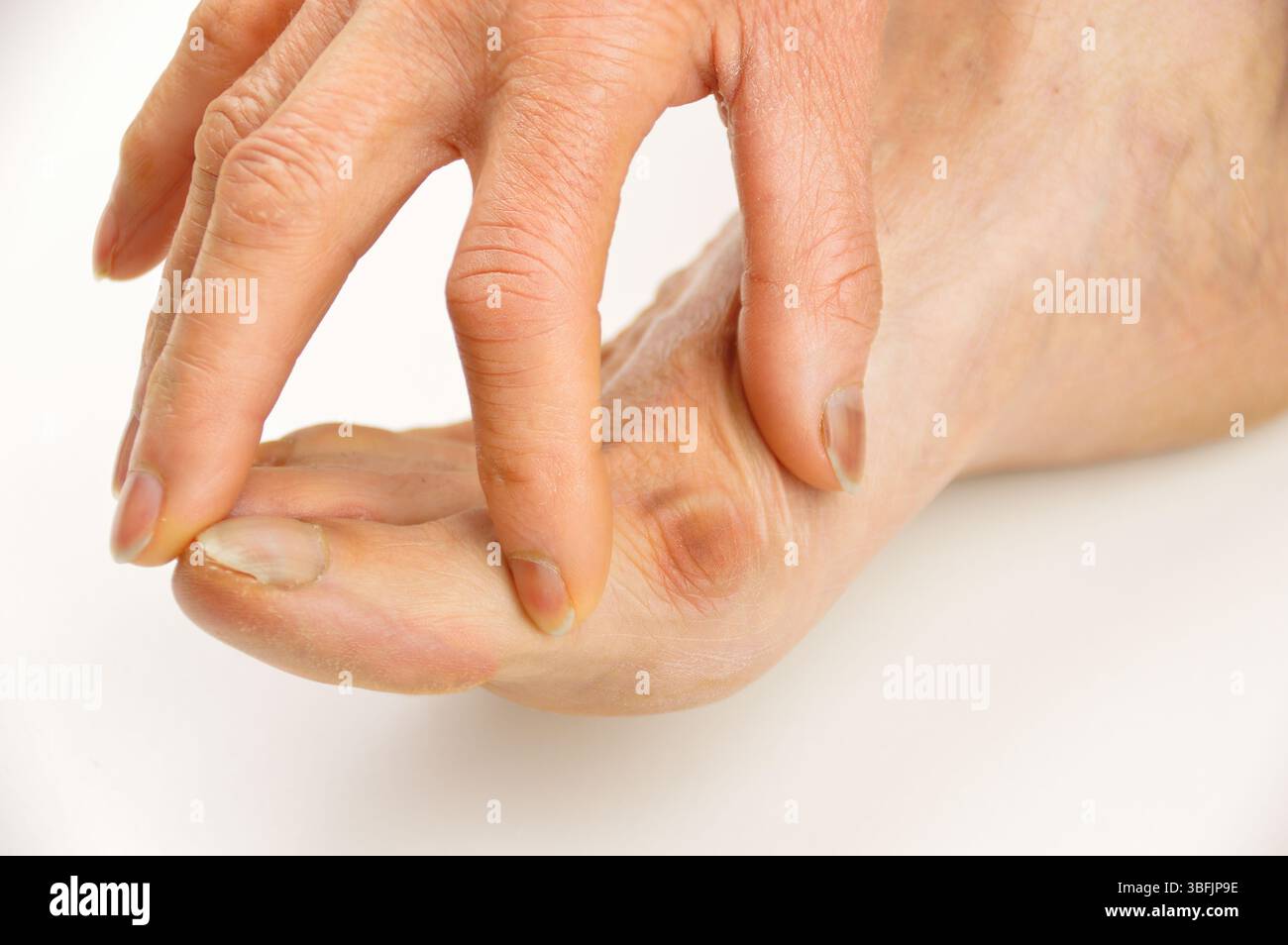 Image en gros plan de la main vérifiant l'oignon de pied souffrance.image de studio horizontale sur fond blanc. Banque D'Images