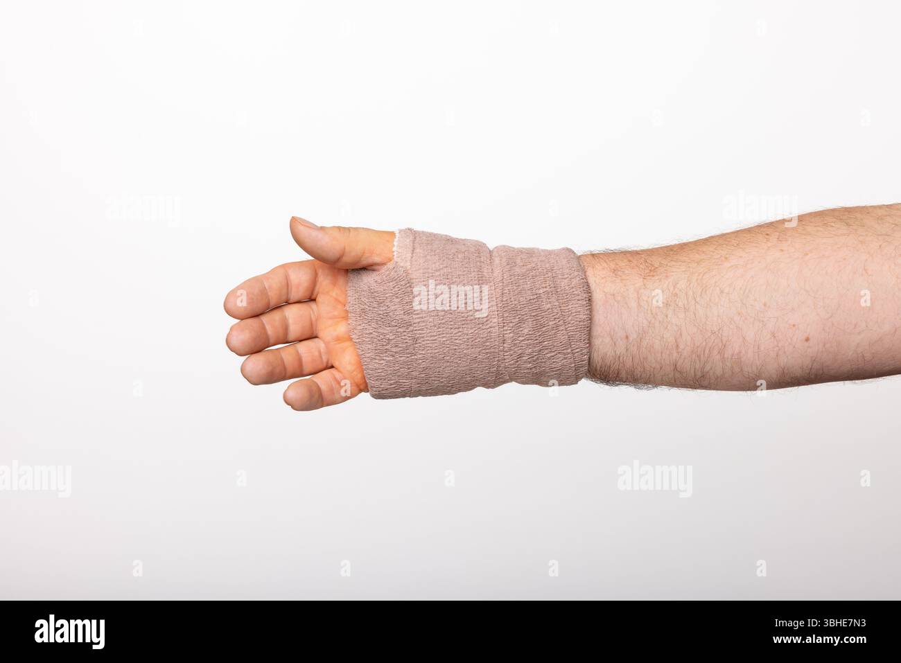 La main et le poignet d'un homme enveloppés dans un bandage de tissu après une chirurgie du canal carpien. Banque D'Images