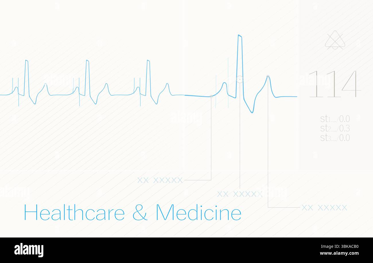 ECG, cardio, cœur, formation médicale Illustration de Vecteur