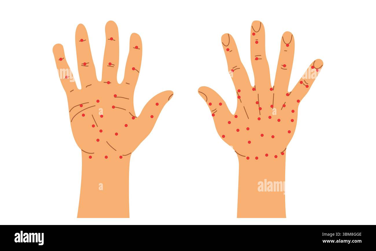 Acupuncture chinoise. Anatomie humaine. Illustration vectorielle de la main droite humaine. Paume et dos de la main. Sujok thérapie et acupuncture Illustration de Vecteur