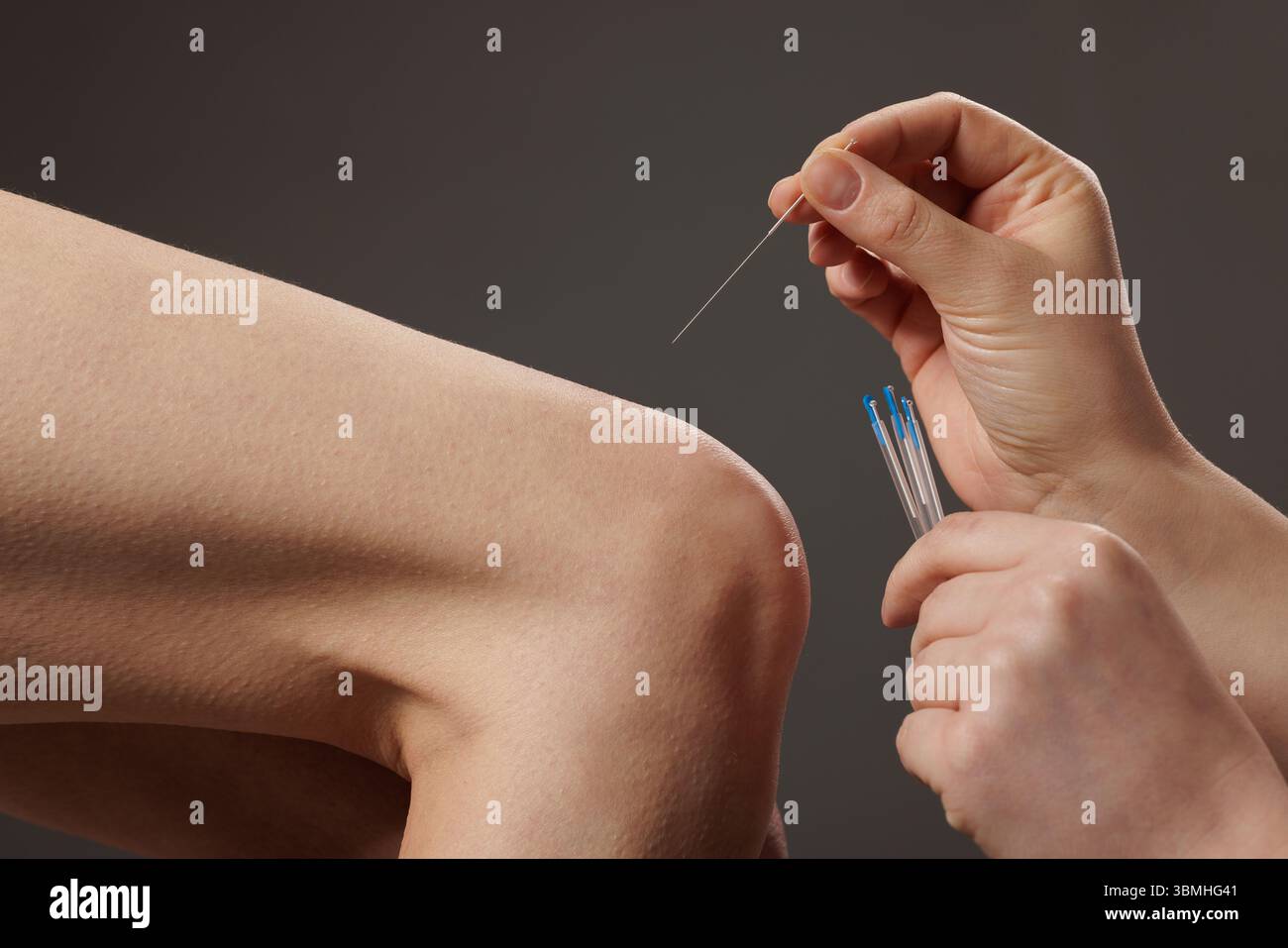 Gros plan de la technique d'aiguilletage sec sur le genou pour soulager la douleur thérapie musculaire et la réadaptation en thérapie physique Banque D'Images