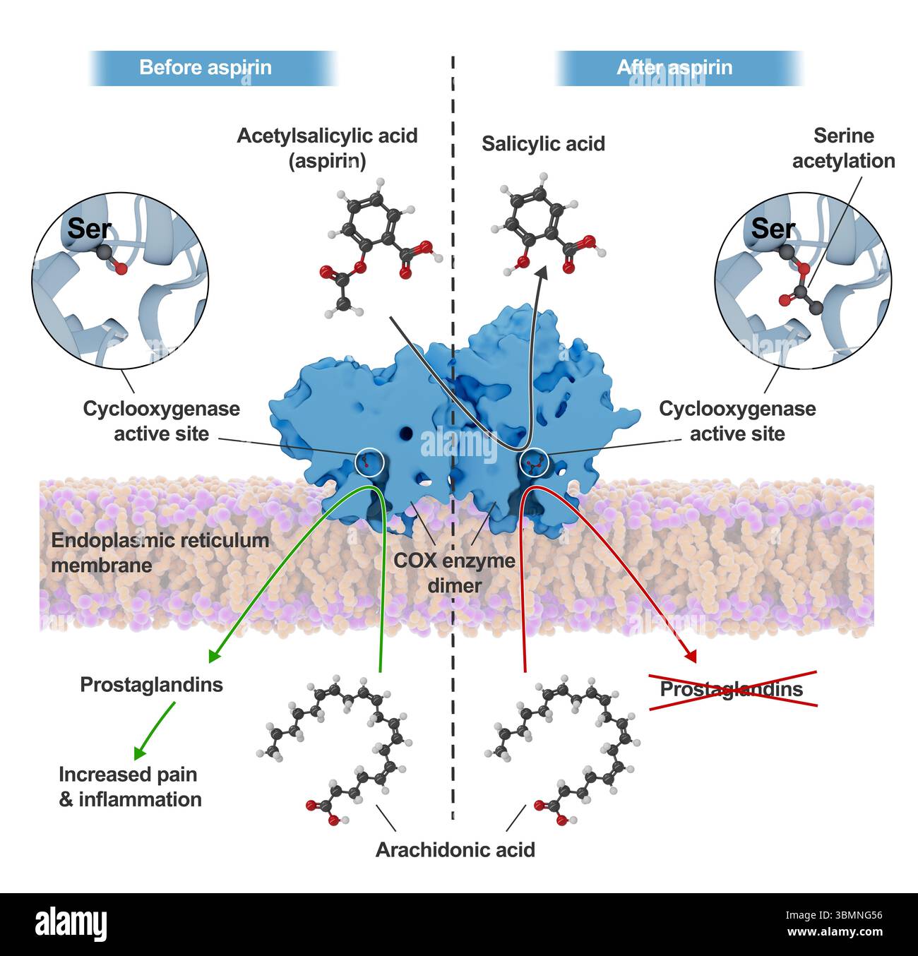 Illustration du mécanisme d'action de l'aspirine au sein de l'enzyme cyclooxygénase (COX). L'aspirine acétyle un résidu sérine clé de la COX, conduisant à un changement structurel irréversible du site actif de la COX qui l'empêche d'agir sur l'acide arachidonique pour produire des réponses inflammatoires. Banque D'Images