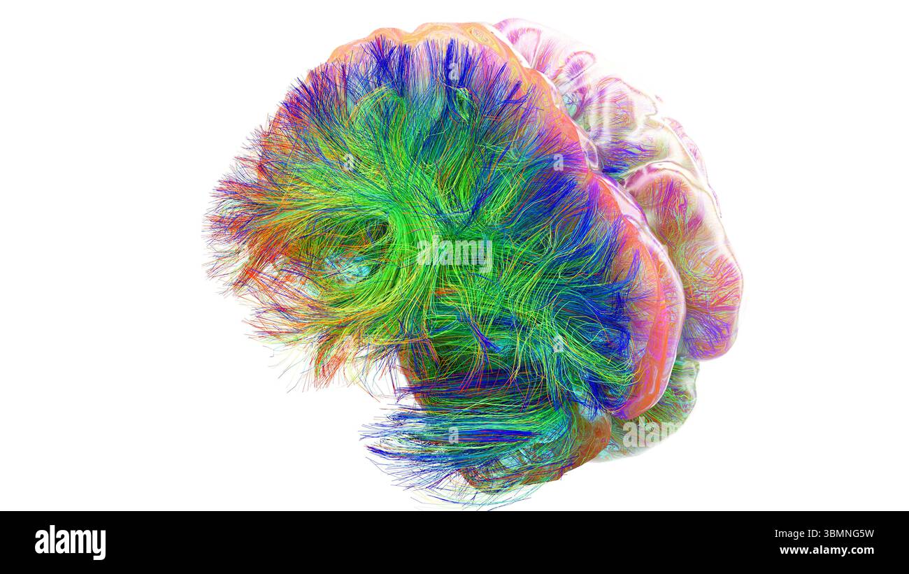 Illustration d'un tractogramme cérébral à haute résolution, représentant le réseau complexe de voies neuronales dans le cerveau humain. Les faisceaux de fibres complexes sont visualisés à l'aide de l'imagerie de tenseur de diffusion avancée (DTI), fournissant des informations sur la connectivité et la structure de la substance blanche du cerveau. Banque D'Images