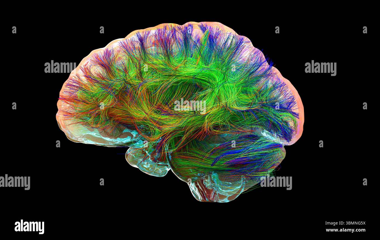 Illustration d'un tractogramme cérébral à haute résolution, représentant le réseau complexe de voies neuronales dans le cerveau humain. Les faisceaux de fibres complexes sont visualisés à l'aide de l'imagerie de tenseur de diffusion avancée (DTI), fournissant des informations sur la connectivité et la structure de la substance blanche du cerveau. Banque D'Images