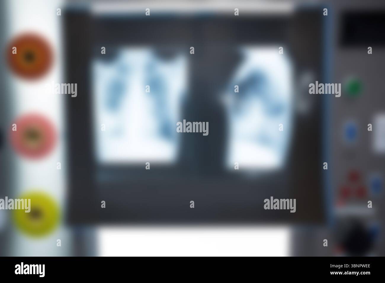 Vue floue du rapport radiographique à l'hôpital Banque D'Images