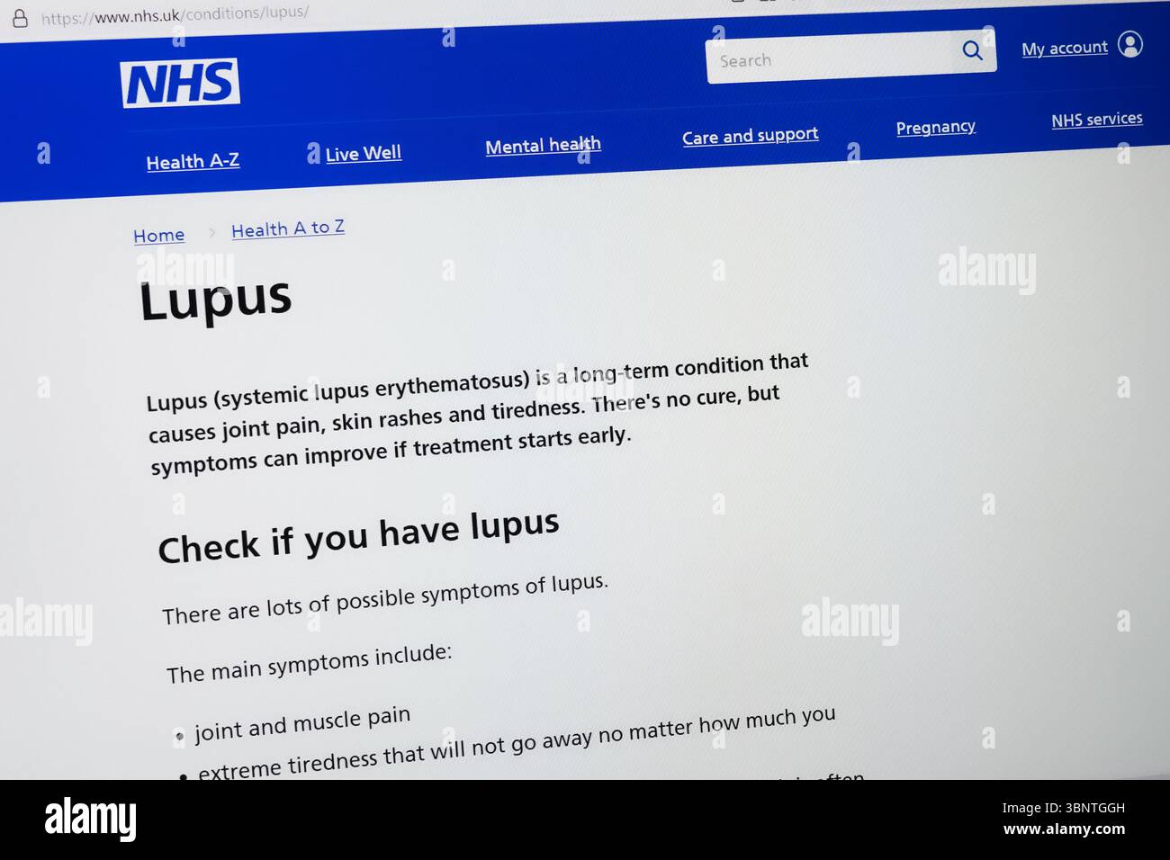 Le site du NHS avec des informations sur le lupus Banque D'Images