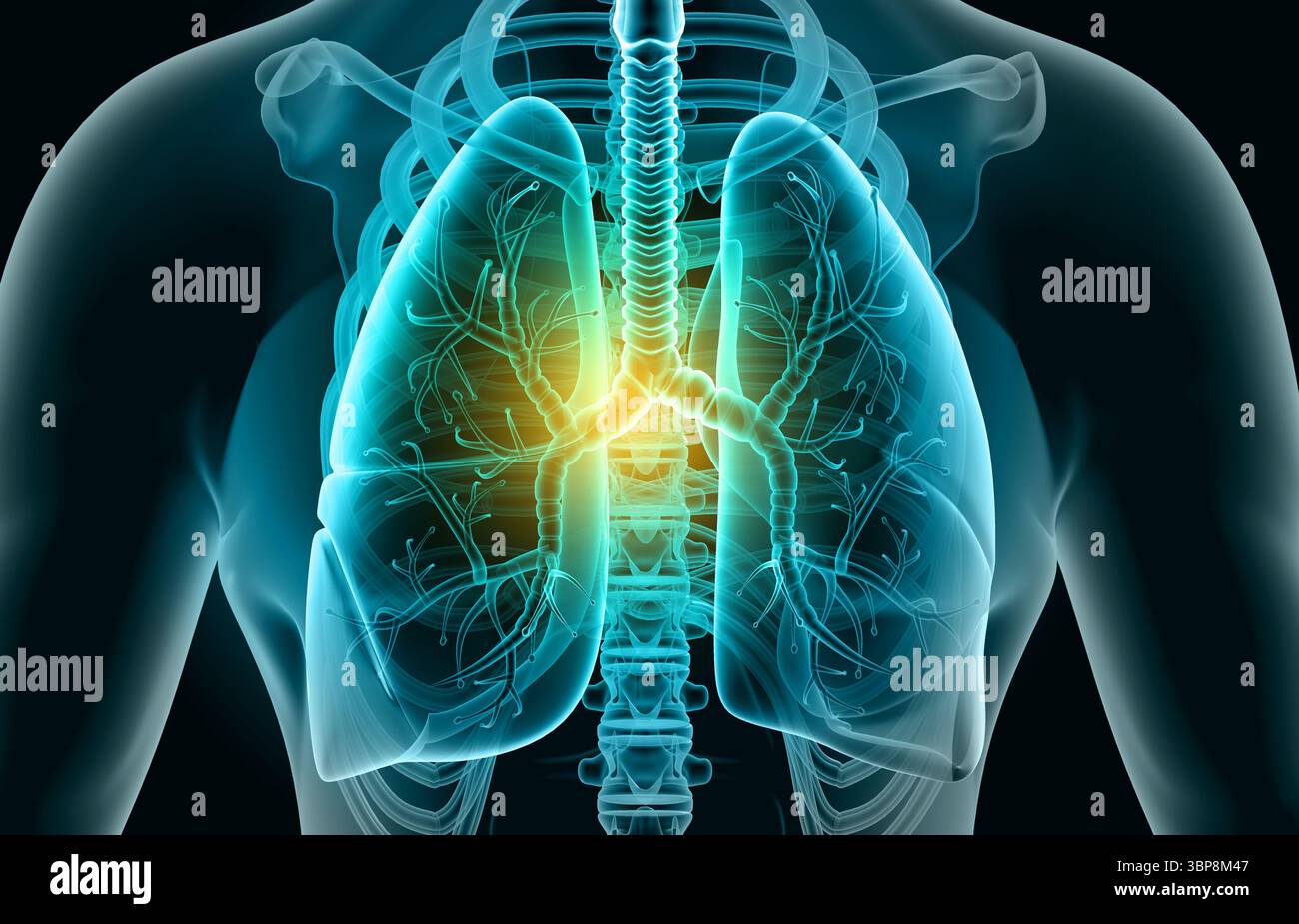 Poumons humains infectés par virus et bactéries. Anatomie des poumons. illustration 3d. Banque D'Images