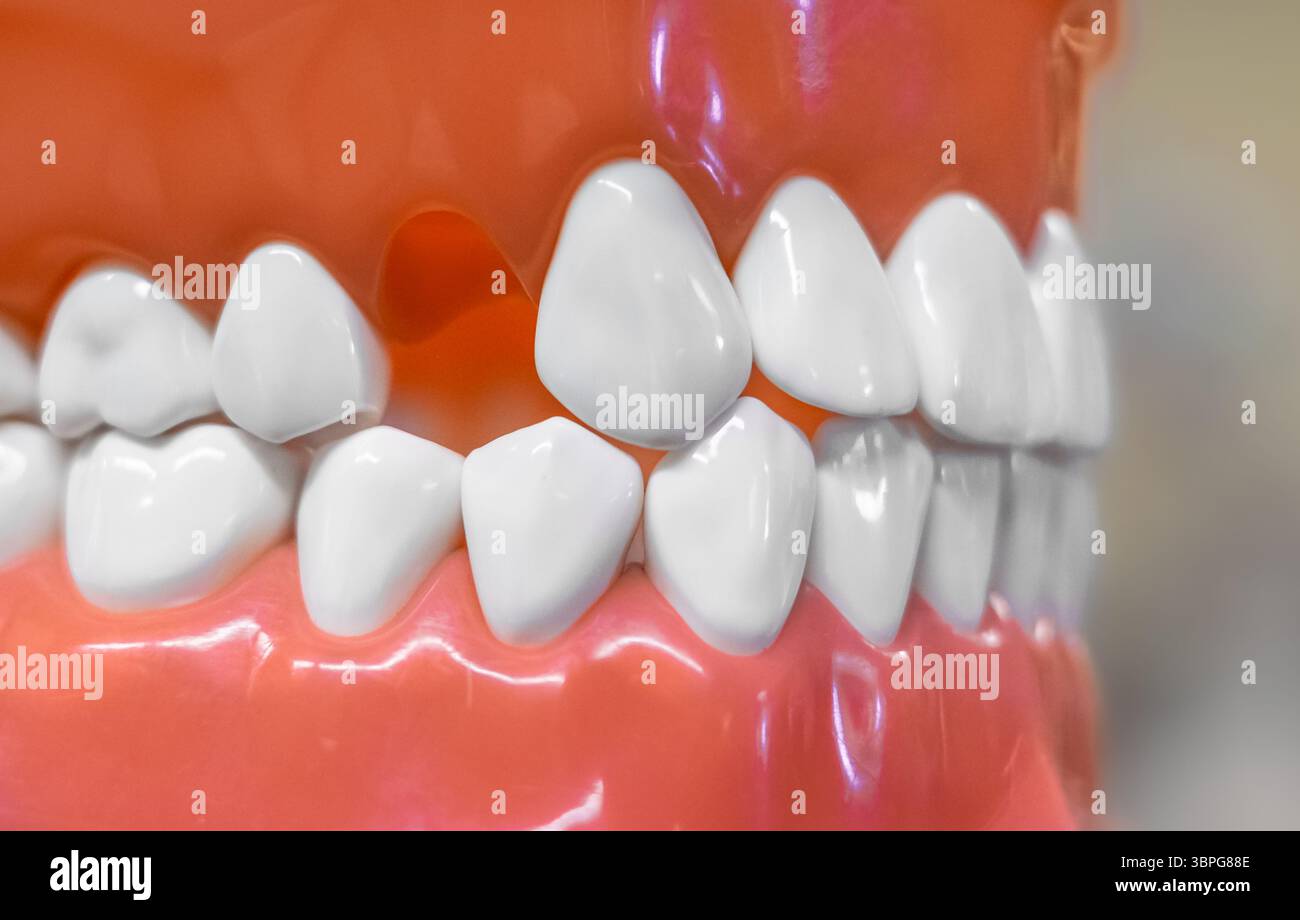 Gros plan d'une mâchoire dentaire avec une dent manquante. Mâchoire humaine artificielle avec modèle anatomique des dents isolé sur fond flou. Dents saines, soins dentaires Banque D'Images