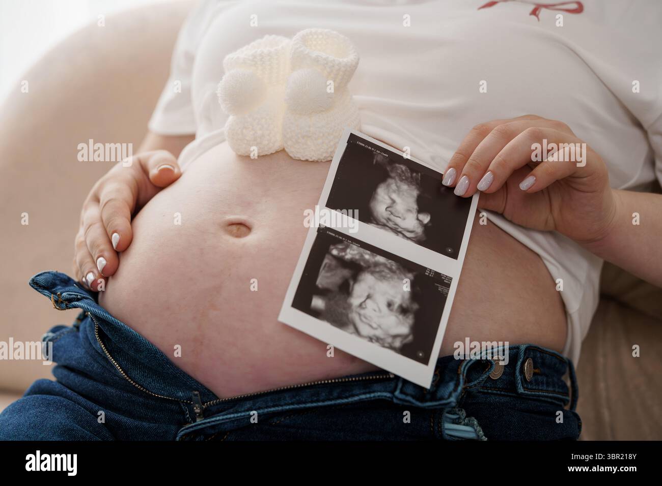 Une image réconfortante montre une femme enceinte tenant tendrement une image échographique à côté d'un petit chausson blanc pour bébé, reposant ses mains sur son rou Banque D'Images