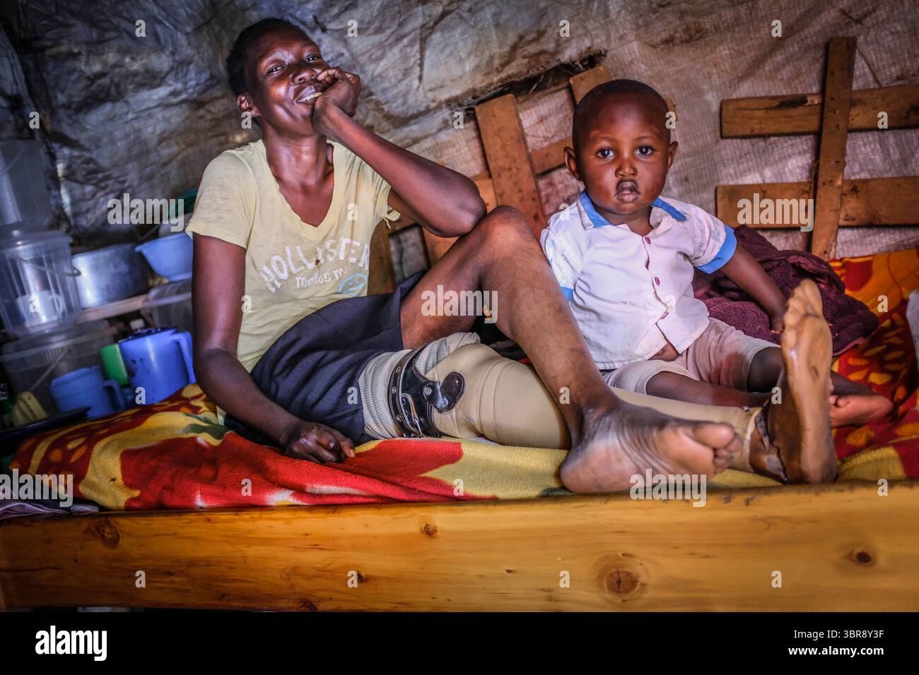6 avril 2020, Nairobi, Kenya : 28 année ol Fibi Achieng est une survivante du poison de serpent qui a eu sa jambe droite a été amputée après avoir conduit à la croissance du cancer. Fibi Achieng, qui est également mère d’un ha, a été laissée sans emploi après la pandémie du Corona virus et s’est forcée de rester à l’intérieur en raison de son état de santé et d’éviter de rester intacte avec des familles et des amis qui pourraient avoir le Corona virus. (Crédit image : © Donwilson Odhiambo/ZUMA Wire) Banque D'Images