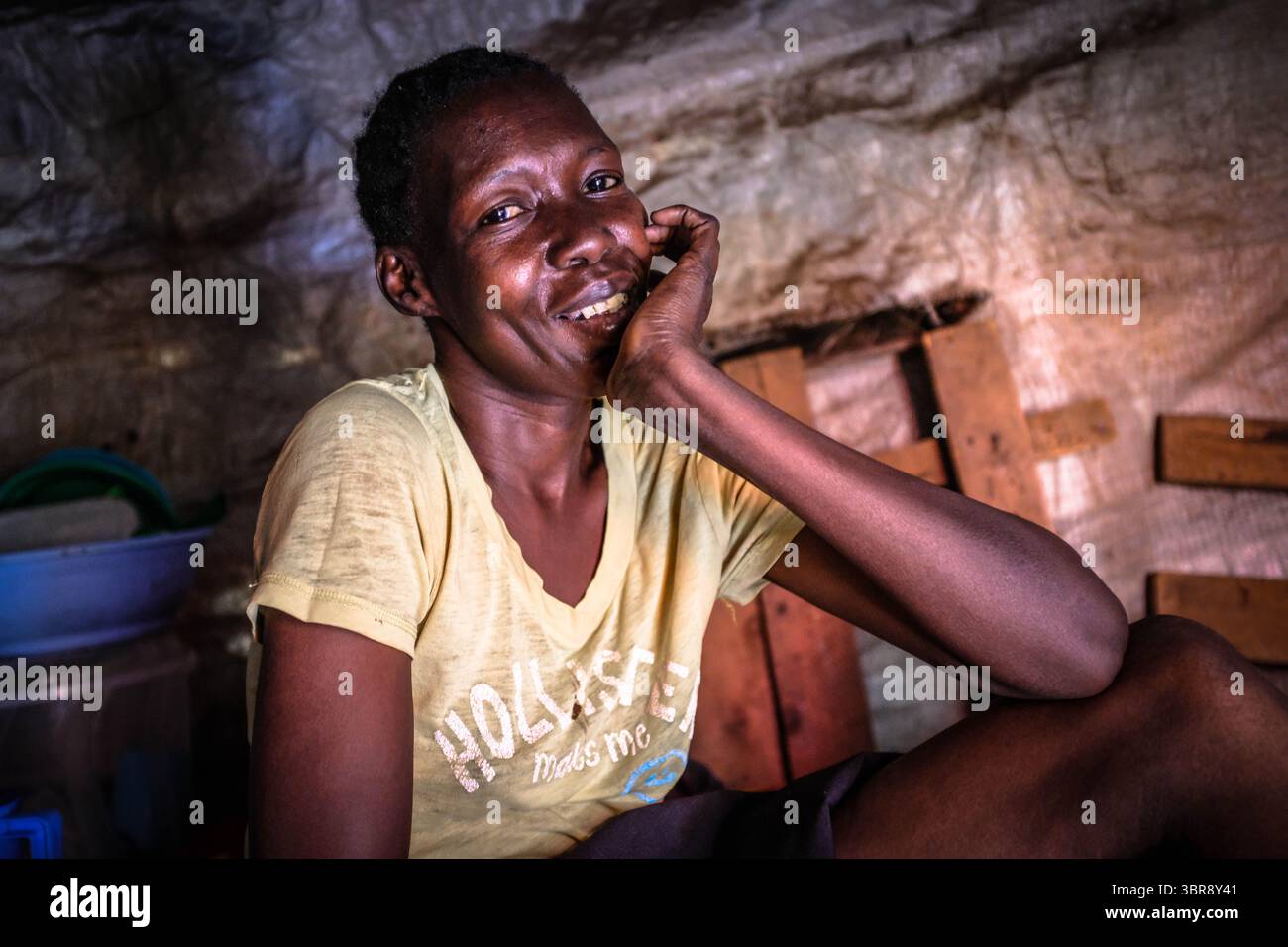 6 avril 2020, Nairobi, Kenya : 28 année ol Fibi Achieng est une survivante du poison de serpent qui a eu sa jambe droite a été amputée après avoir conduit à la croissance du cancer. Fibi Achieng, qui est également mère d’un ha, a été laissée sans emploi après la pandémie du Corona virus et s’est forcée de rester à l’intérieur en raison de son état de santé et d’éviter de rester intacte avec des familles et des amis qui pourraient avoir le Corona virus. (Crédit image : © Donwilson Odhiambo/ZUMA Wire) Banque D'Images
