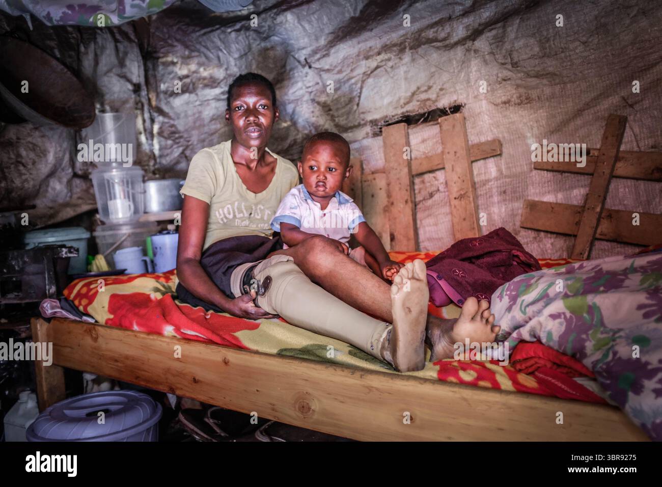 6 avril 2020, Nairobi, Kenya : 28 année ol Fibi Achieng est une survivante du poison de serpent qui a eu sa jambe droite a été amputée après avoir conduit à la croissance du cancer. Fibi Achieng, qui est également mère d’un ha, a été laissée sans emploi après la pandémie du Corona virus et s’est forcée de rester à l’intérieur en raison de son état de santé et d’éviter de rester intacte avec des familles et des amis qui pourraient avoir le Corona virus. (Crédit image : © Donwilson Odhiambo/ZUMA Wire) Banque D'Images