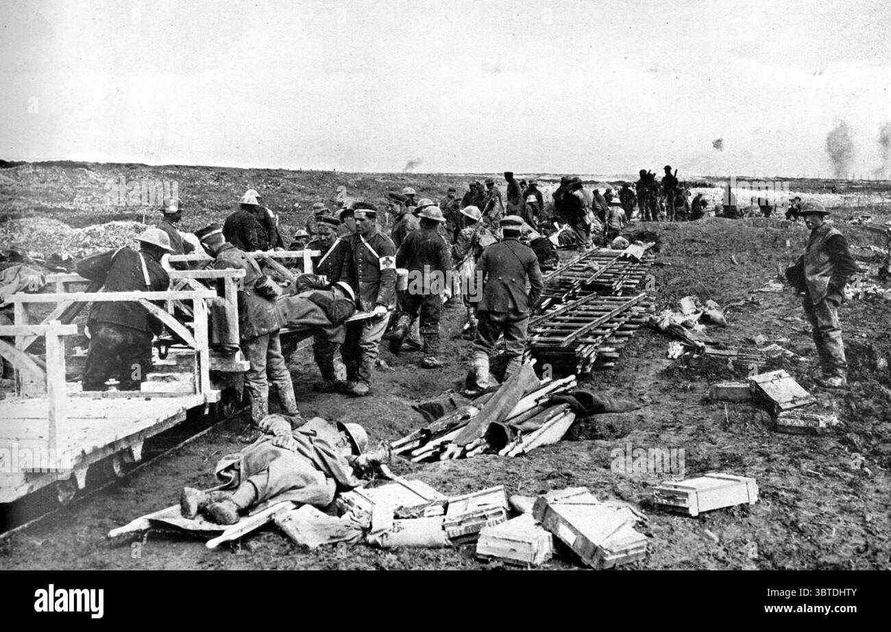 L'offensive britannique sur le front occidental - quelques-uns des derniers records de Vimy . Cette vue montre que les chemins de fer légers , reportés en sections , sont en contact étroit avec les forces avançant dans le district de la crête de Vimy . Les blessés sont vus en train d'être transportés au poste médical le plus proche. 28 avril 1917 Banque D'Images