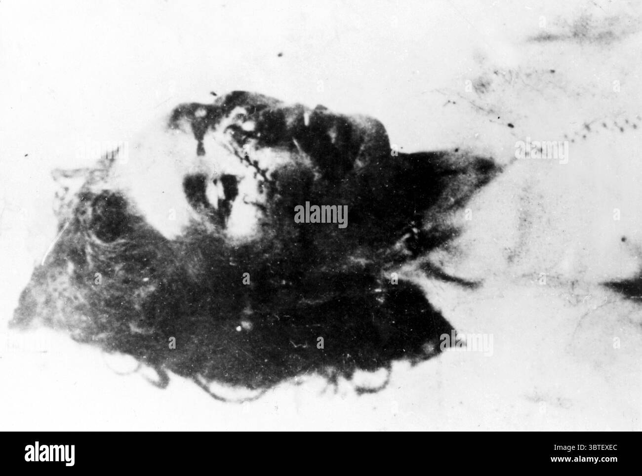 Jack l'Éventreur une des victimes (sans légende) Banque D'Images