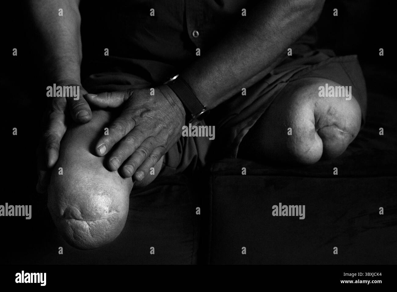 8 juillet 2021, Biyawele, gouvernorat de Halabja, Kurdistan irakien : le démineur de mines terrestres Hoshyar Ali pose pour un portrait à son domicile dans le village de Biyawele près de Halabja, Kurdistan irakien, le 8 juillet 2021. Ali est un héros local. Selon ses propres informations, heÃs a secouru 182 personnes des champs de mines, déminé 104 villages, déminé 540 kilomètres carrés de terres, enseigné la sensibilisation aux mines terrestres à au moins 700 écoles et mis en sécurité plus de 2,5 millions de mines terrestres et de munitions non explosées, nombre de celles qu'il a déminées en tant que double amputé ayant perdu ses deux jambes à cause de mines terrestres. (Crédit image : © Daniel Carde/ZUMA Press Wire) Banque D'Images