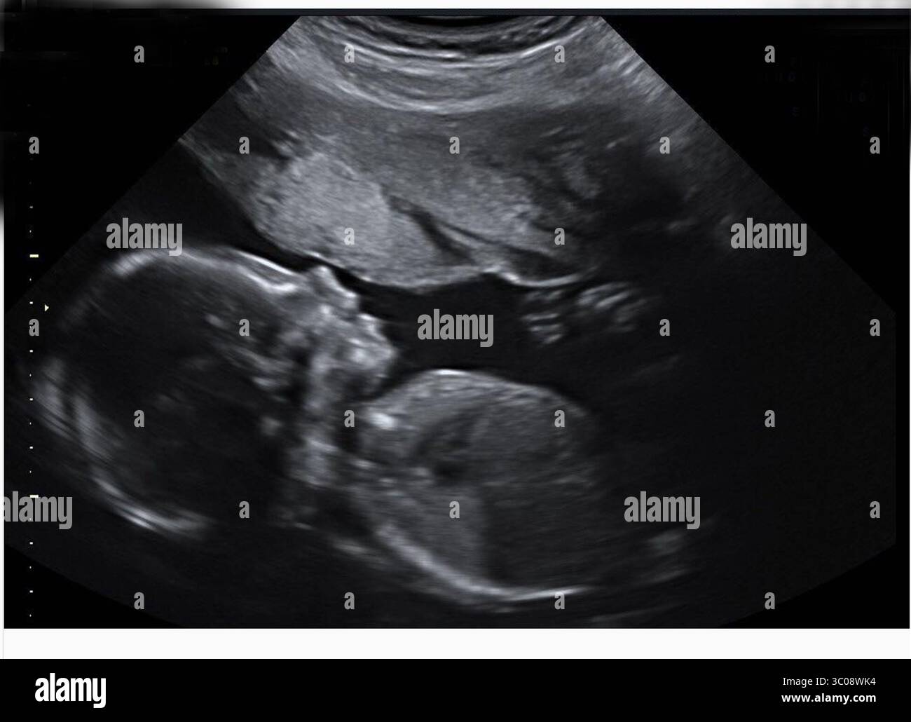 UNITED S : L'acteur superstar de Wedding Crashers Owen Wilson a sa première petite fille Lyla Aranya Wilson, née le 10-09-18 avec Varunie Vongsvirates ..personnes : Varunie Vongsvirates (crédit image : © SMG via ZUMA Wire) Banque D'Images