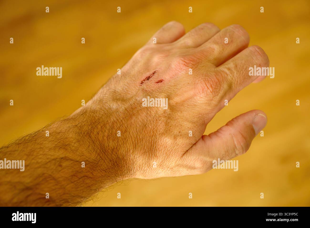 Gros plan de la main d'un homme avec une petite blessure fraîche sur le dos, peut-être d'une égratignure ou d'une éraflure. La peau environnante montre une texture et des cheveux naturels Banque D'Images