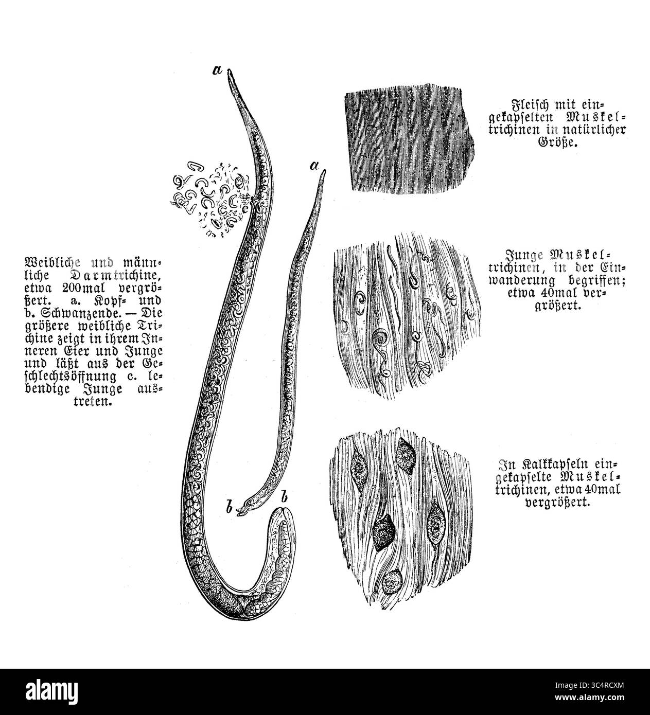 Parasites : vers trichines ou vers ronds ou trichinella (ici 200 fois amplifiés) vivant comme parasites intracellulaires des animaux et des humains, gravure du XIXe siècle Banque D'Images