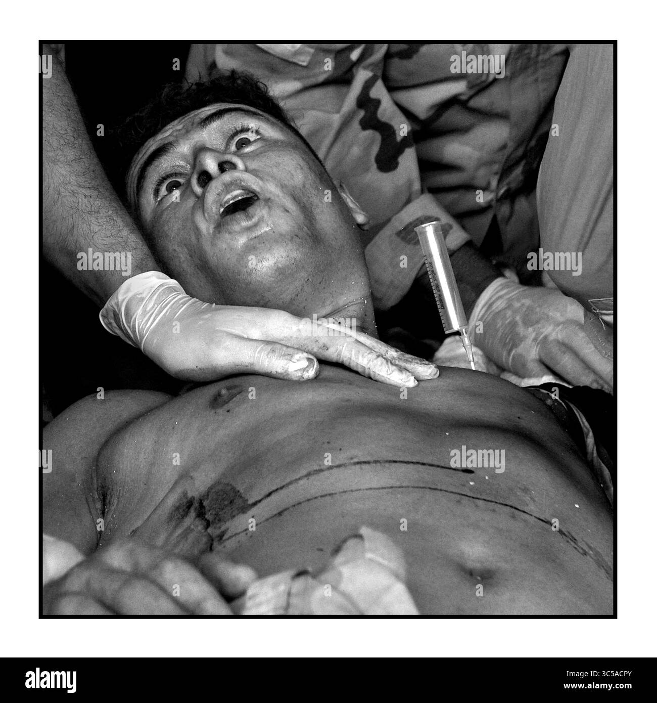 13 juillet 2017 - Mossoul, Irak - Un soldat de l'armée irakienne grièvement blessé reçoit des soins médicaux d'urgence sur un site de traumatologie avec l'équipe de gestion de l'intervention mondiale le 13 juillet 2017 au milieu des ruines de la vieille ville. Le bilan de la guerre - même avec des efforts médicaux héroïques, ce soldat est mort dans l'ambulance sur le chemin de l'hôpital. La bataille avec l'Etat islamique se poursuit dans une petite partie de Mossoul occidental, même si elle a été déclarée libérée il y a quelques jours. Les blessures causées par les kamikazes, les grenades et les tireurs d'élite continuent alors que les combattants de l'Etat islamique utilisent les tunnels pour poursuivre le conflit acharné. (Crédit image : © Carol Guzy/ZUMA Wire) Banque D'Images