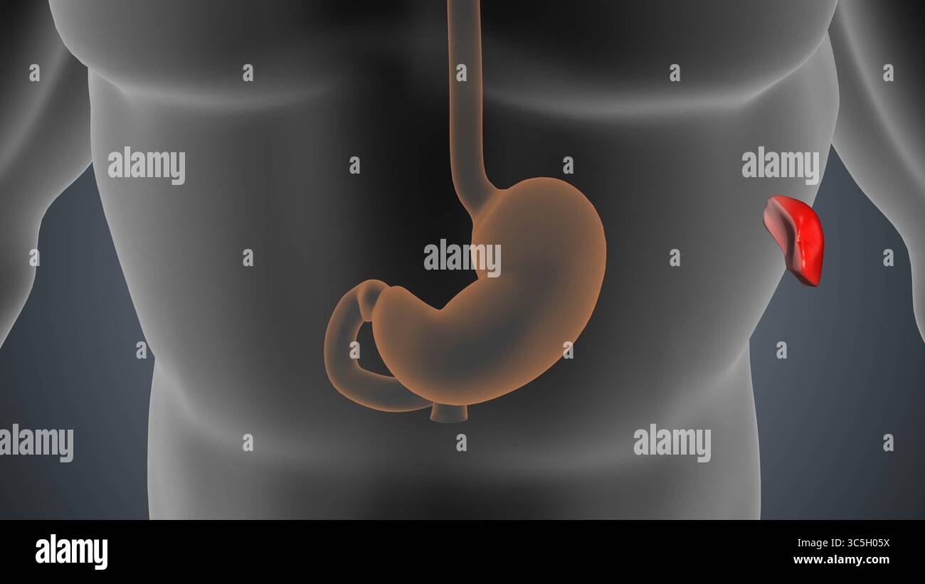 Animation de chirurgie d'ablation de rate de splénectomie Banque D'Images