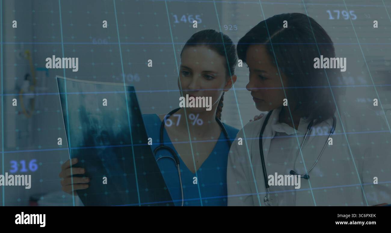 Deux médecins en gommage et en blouse de laboratoire étudient des films radiographiques en clinique, avec superposition de données numériques Banque D'Images