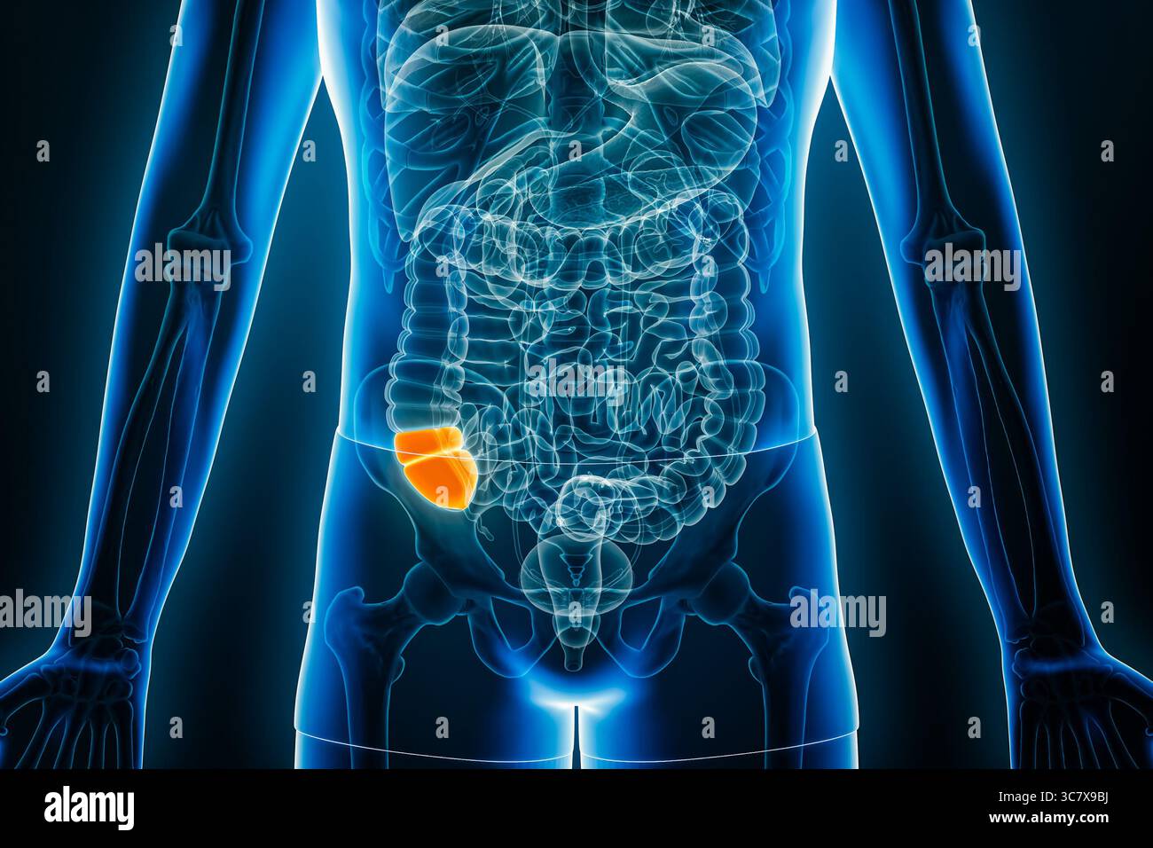 Vue radiographique antérieure ou de face du caecum, partie du côlon humain, illustration de rendu 3D avec contours du corps. Anatomie, organe du système digestif, Banque D'Images