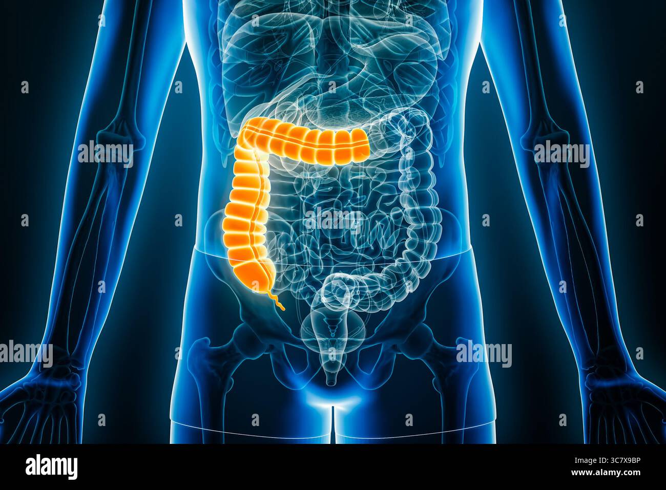 Vue radiographique antérieure ou frontale du côlon proximal ou droit, illustration de rendu 3D avec contours corporels. Anatomie humaine, organe du syst digestif Banque D'Images
