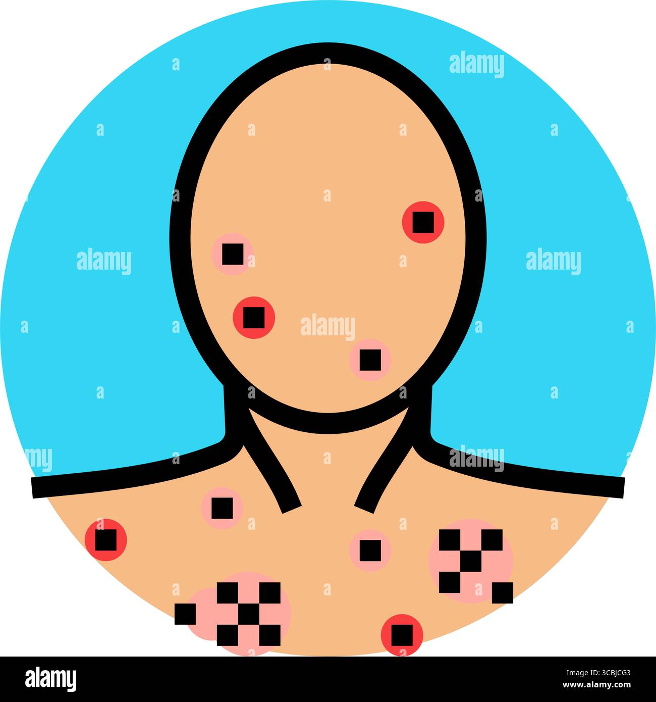 illustration vectorielle d'icône de couleur de puberté d'acné adolescence Illustration de Vecteur