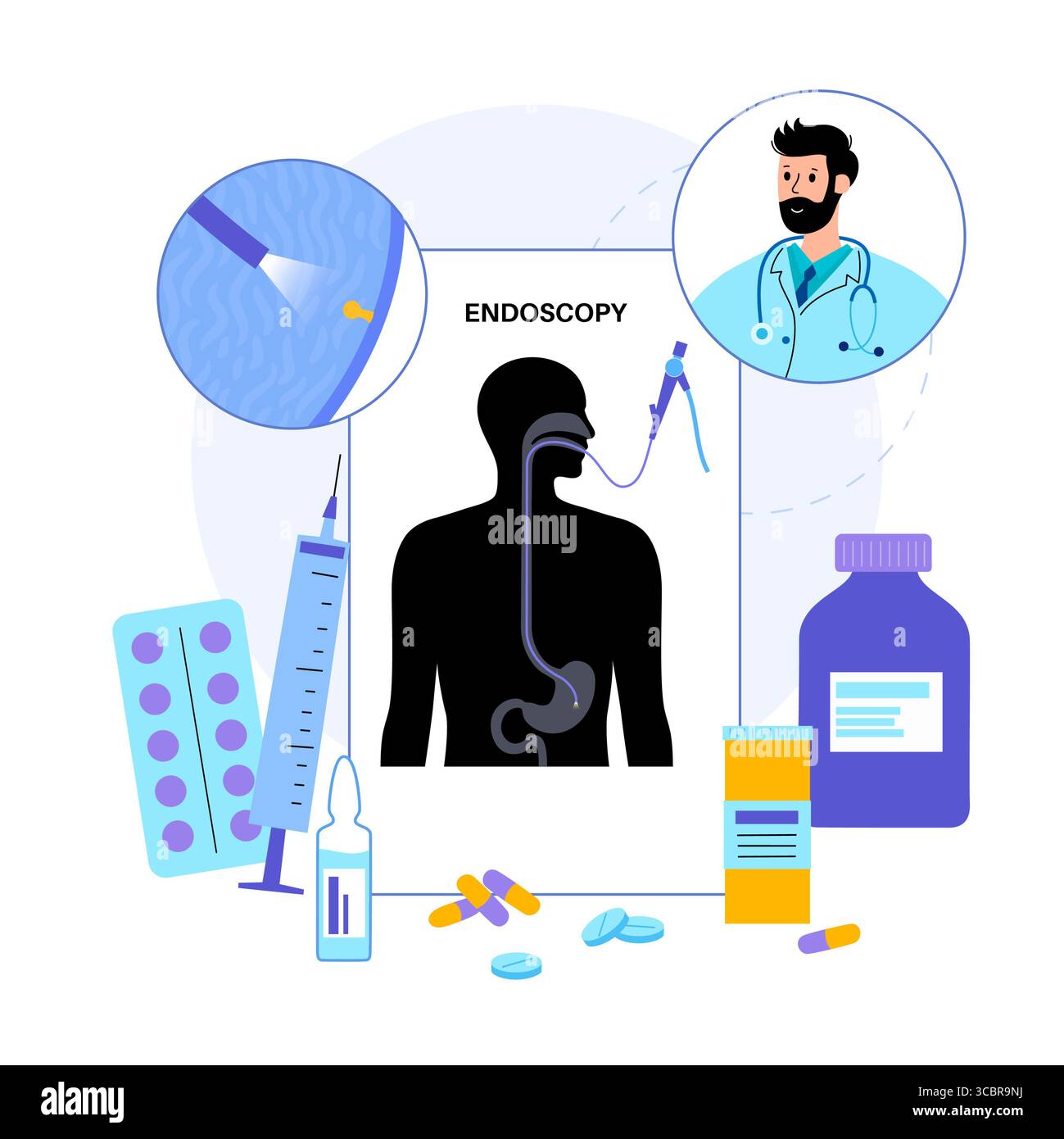 Illustration d'une gastroscopie, également connue sous le nom d'endoscopie supérieure. Il s'agit d'une procédure où un endoscope est inséré par la bouche pour examiner l'œsophage, l'estomac et le duodénum. Il aide à diagnostiquer et à traiter des affections comme les ulcères, les inflammations ou les tumeurs dans le tube digestif supérieur. Banque D'Images