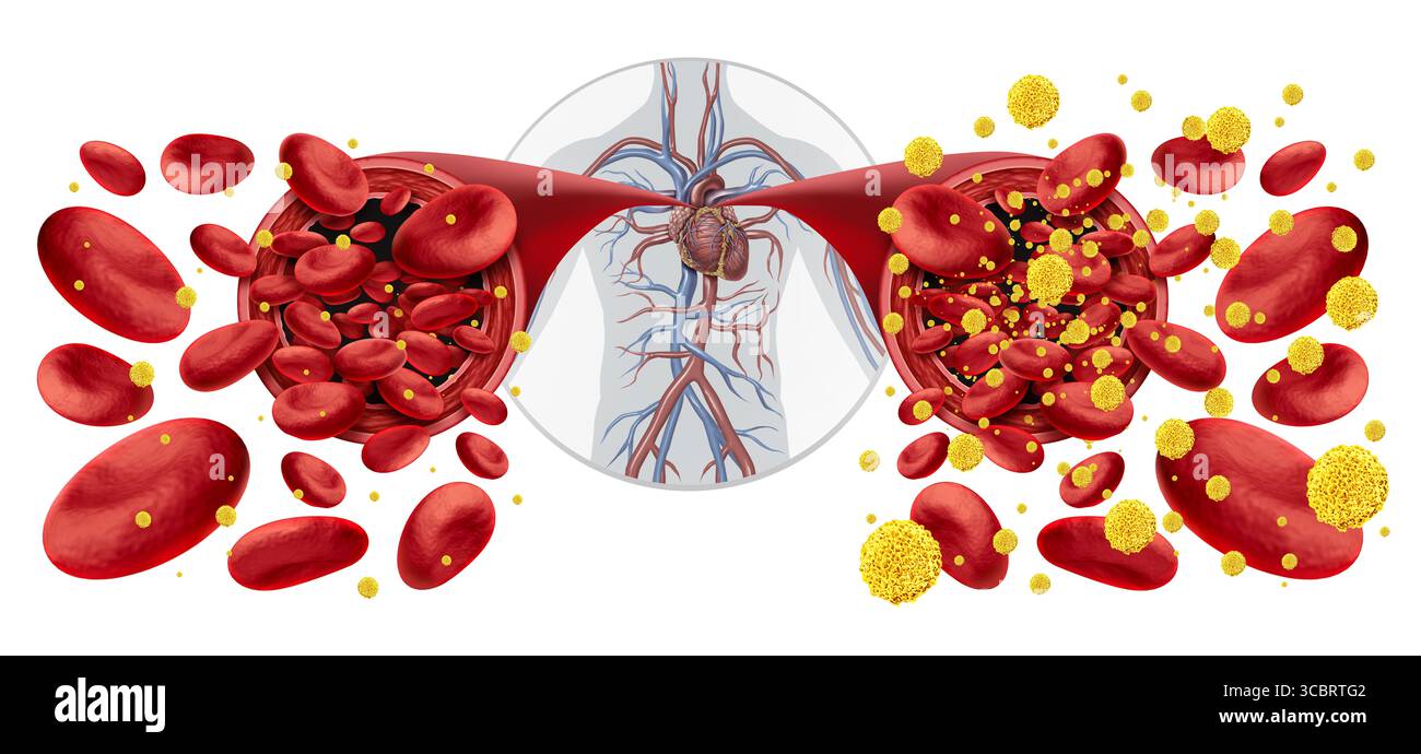 Symptômes du diabète et glycémie diabétique comme symbole d'hypoglycémie et d'hyperglycémie ou taux de glucose normal comme symbole de sang faible ou élevé Banque D'Images