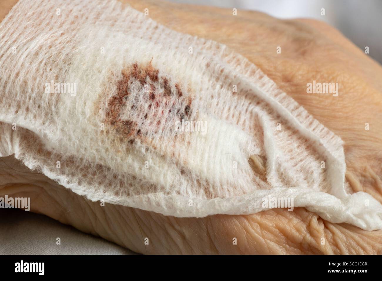Main de femme âgée avec bandage sanglant après injection dans la veine, couché sur le lit à l'hôpital, le traitement et la santé Banque D'Images