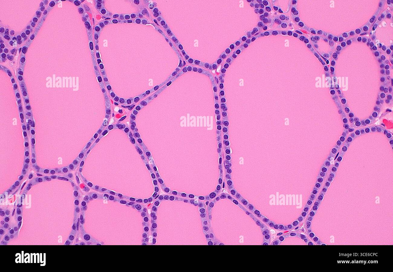 Micrographie lumineuse des follicules thyroïdiens. La glande thyroïde est composée de nombreuses structures appelées follicules. Les follicules sont les structures polygonales qui sont délimitées par des cellules folliculaires (bleu-violet pâle avec des points violets) et contiennent une substance colloïdale (rose). On voit également entre quelques follicules de petits vaisseaux sanguins contenant des globules rouges (rouge vif). Coupe de tissu colorée à l'hématoxyline et à l'éosine. Grossissement : 200x lorsqu'il est imprimé à 10cm. Banque D'Images