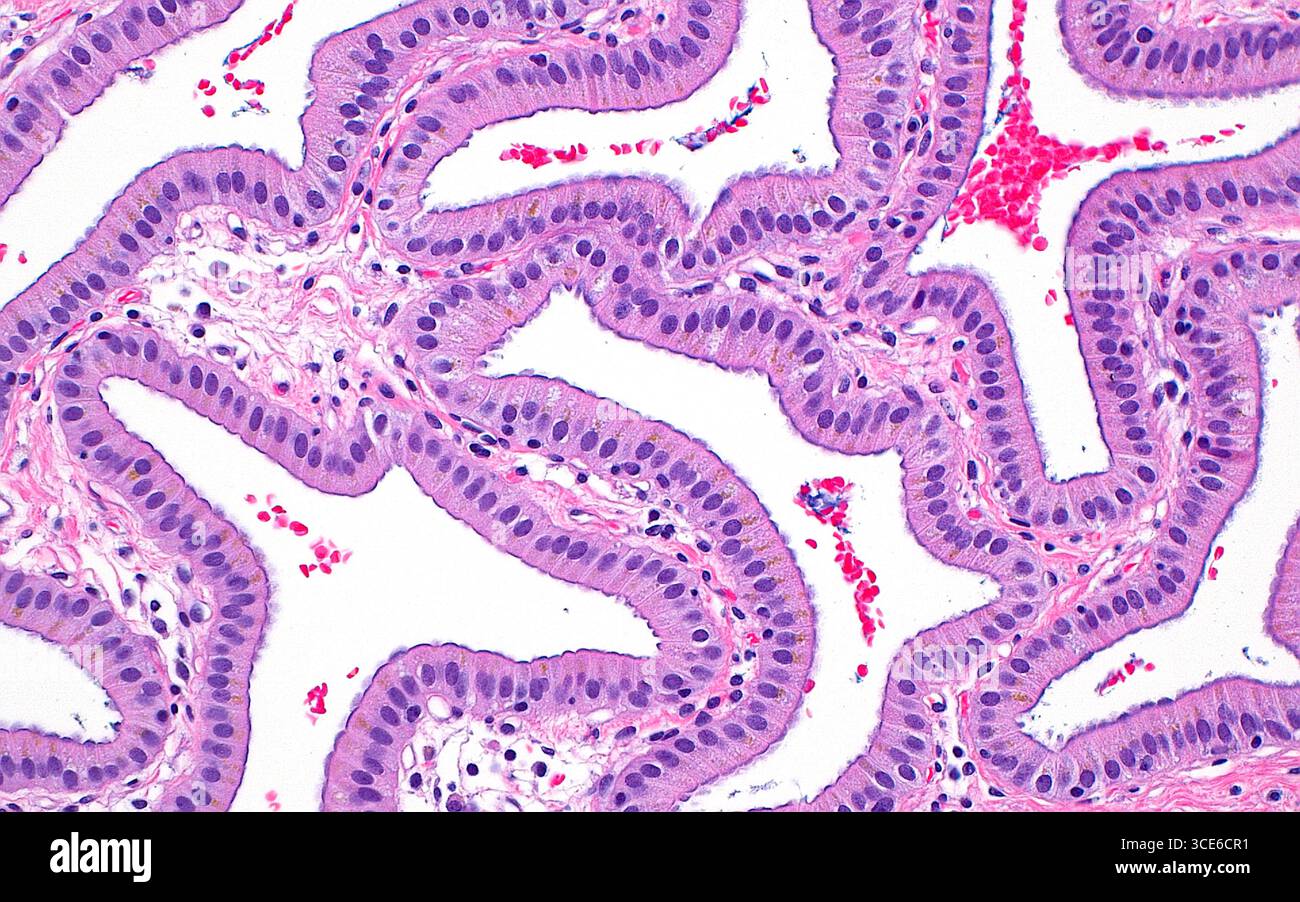 Micrographie à la lumière de l'épithélium de la vésicule biliaire, qui est le groupe de cellules qui tapissent la surface interne de la vésicule biliaire. Les cellules épithéliales ont des noyaux ronds (points bleus) et un cytoplasme orienté verticalement (rose clair). Sous les cellules épithéliales se trouve du tissu conjonctif lâche (brins rose clair) entrecoupé de cellules inflammatoires clairsemées (points bleus plus petits et plus foncés). Coupe de tissu colorée à l'hématoxyline et à l'éosine. Grossissement : 200x lorsqu'il est imprimé à 10cm. Banque D'Images