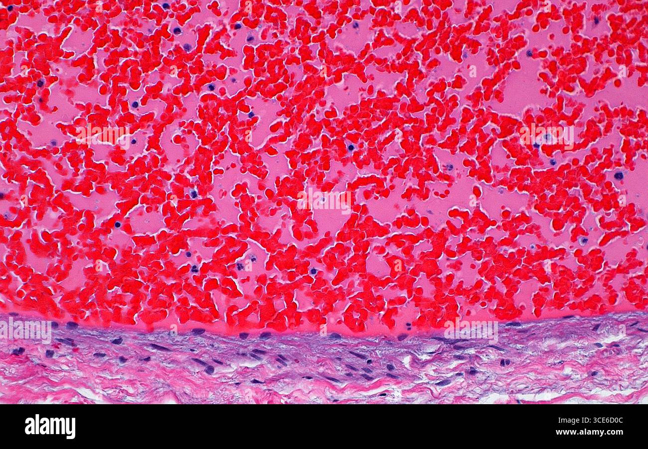 Micrographie lumineuse d'un vaisseau sanguin. La paroi du vaisseau sanguin est visible au bas de l'image et montre la couche médiane (violet clair) constituée du muscle lisse et l'adventice (rose clair) qui est la couche externe du tissu conjonctif. La majeure partie de l'image est occupée par la lumière du vaisseau qui contient des globules rouges (rouge vif), du sérum (rose) et des leucocytes ou des globules blancs (petits points bleu foncé). Coupe de tissu colorée à l'hématoxyline et à l'éosine. Grossissement : 200x lorsqu'il est imprimé à 10cm. Banque D'Images