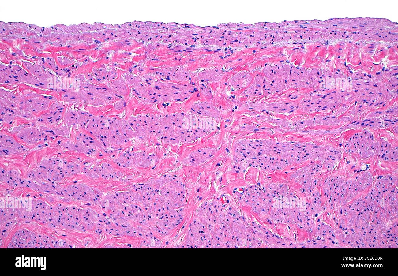 Micrographie lumineuse de la paroi d'une veine rénale. La veine rénale est la veine principale qui recueille le sang après son passage dans les reins. La paroi de la veine rénale a des morceaux de muscle lisse (zones rose plus clair avec de nombreux points bleus) parmi le stroma fibreux (zones rose plus foncé entre les morceaux rose clair). Coupe de tissu colorée à l'hématoxyline et à l'éosine. Grossissement : 100x lorsqu'il est imprimé à 10cm. Banque D'Images