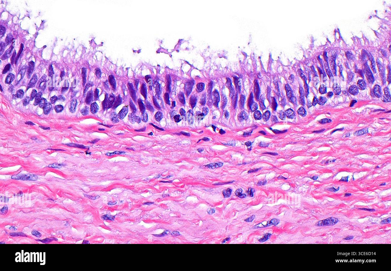 Micrographie à la lumière de l'épithélium du canal déférent. Le canal déférent est un tube qui transporte le sperme du testicule à l'urètre dans le tractus génital masculin. L'épithélium ou les cellules de revêtement du canal déférent ont une disposition colonnaire (orientée verticalement et allongée) et des cils (structures capillaires) faisant saillie dans la lumière (blanche). Coupe de tissu colorée à l'hématoxyline et à l'éosine. Grossissement : 400x lorsqu'il est imprimé à 10cm. Banque D'Images