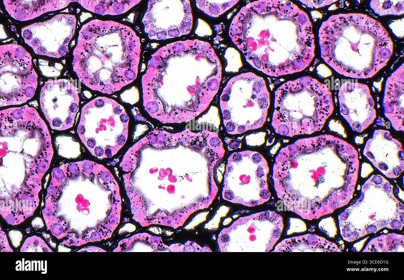 Micrographie lumineuse des tubules corticaux rénaux et des capillaires péritubulaires. Les grands cercles de cette image sont des tubules du cortex rénal. On peut voir le cytoplasme (rose) et les noyaux (cercles violets pâles) des tubules et de leurs membranes basales (lignes noires). Entre les tubules se trouvent des capillaires (structures circulaires plus petites) connus sous le nom de capillaires péritubulaires, qui fournissent le sang et les nutriments aux tissus. Coupe de tissu colorée à l'argent Jones. Grossissement : 400x lorsqu'il est imprimé à 10cm. Banque D'Images