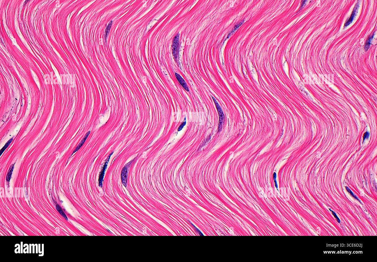 Micrographie à la lumière des fibres de collagène. Les fibres de collagène constituent le tissu conjonctif dans une grande partie du corps humain. Les fibres (roses) sont disposées en brins parallèles avec des noyaux de fibroblastes intercalés (structures violettes allongées). Coupe de tissu colorée à l'hématoxyline et à l'éosine. Grossissement : 400x lorsqu'il est imprimé à 10cm. Banque D'Images