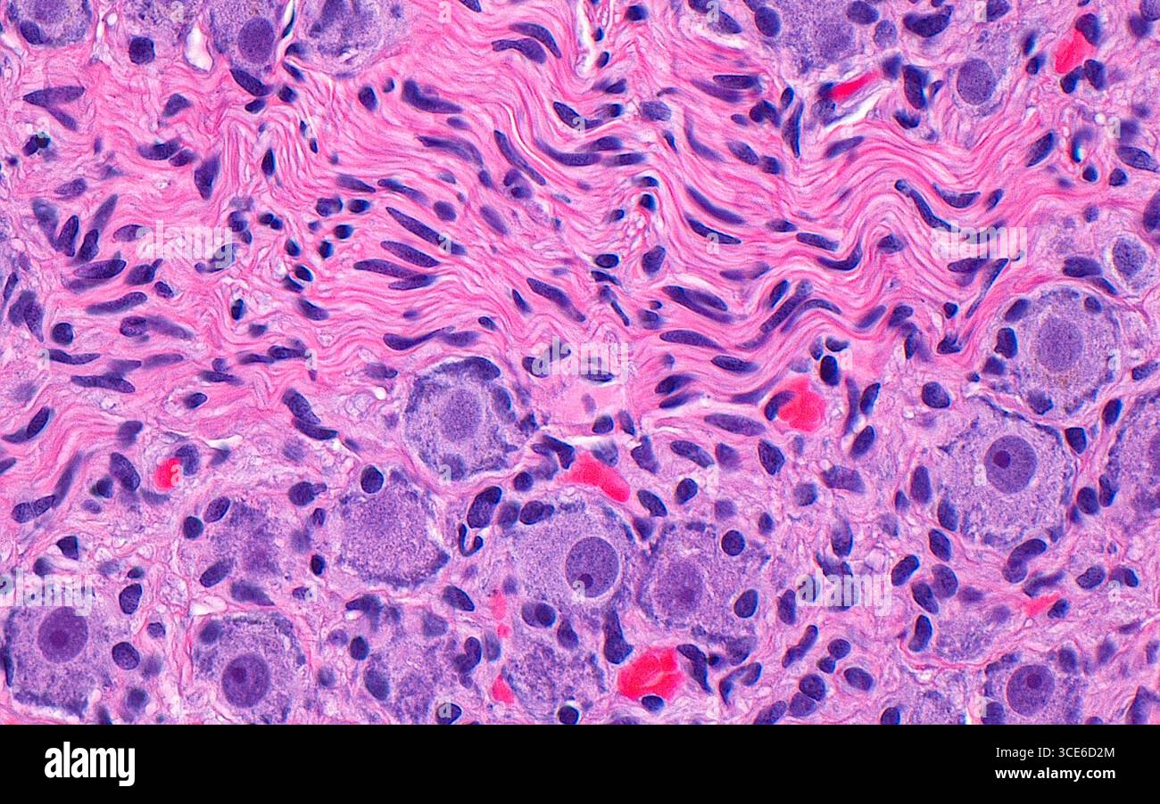 Micrographie lumineuse d'un ganglion nerveux. Les corps cellulaires ganglionnaires ont des noyaux ronds (cercles violets) avec de grands nucléoles (points violets foncés à l'intérieur de cercles violets plus clairs) et un cytoplasme abondant (violet le plus clair). Il y a des fibres nerveuses (rose, la plupart de la moitié supérieure de l'image) avec des noyaux fuselés (courtes lignes oblongues violettes). Coupe de tissu colorée à l'hématoxyline et à l'éosine. Grossissement : 400x lorsqu'il est imprimé à 10cm. Banque D'Images