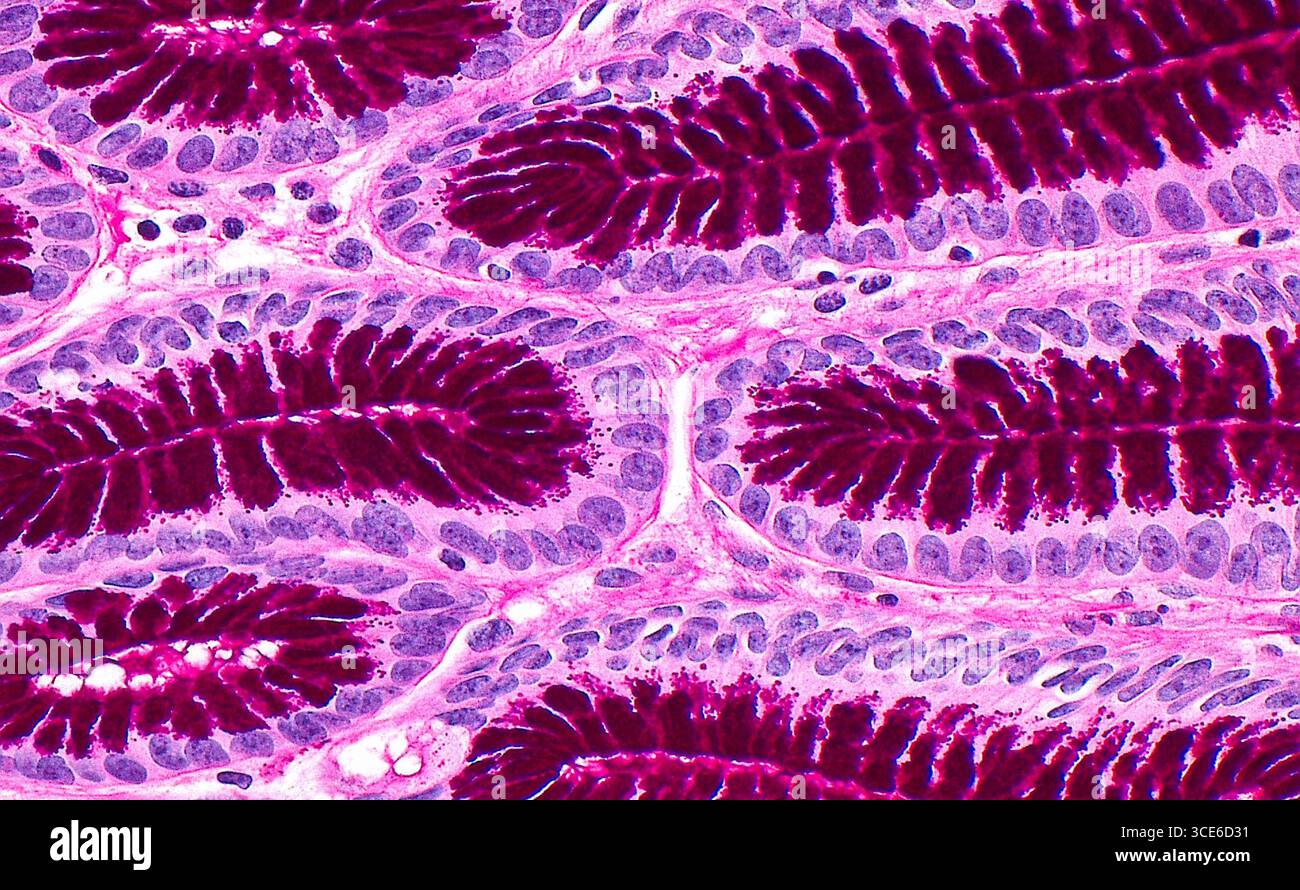 Micrographie à la lumière de l'épithélium fovéolaire gastrique, qui se compose des cellules tapissant normalement l'estomac. Les cellules fovéolaires ont des noyaux ronds (cercles bleu pâle à violet). Le cytoplasme des cellules contient de la mucine, qui se colore en rouge foncé par une coloration au pas. Les cellules fovéolaires sont disposées dans des glandes séparées par un tissu conjonctif mince (brins rose clair). Coupe de tissu coloré à l'acide périodique de Schiff (pas). Grossissement : 400x lorsqu'il est imprimé à 10cm. Banque D'Images