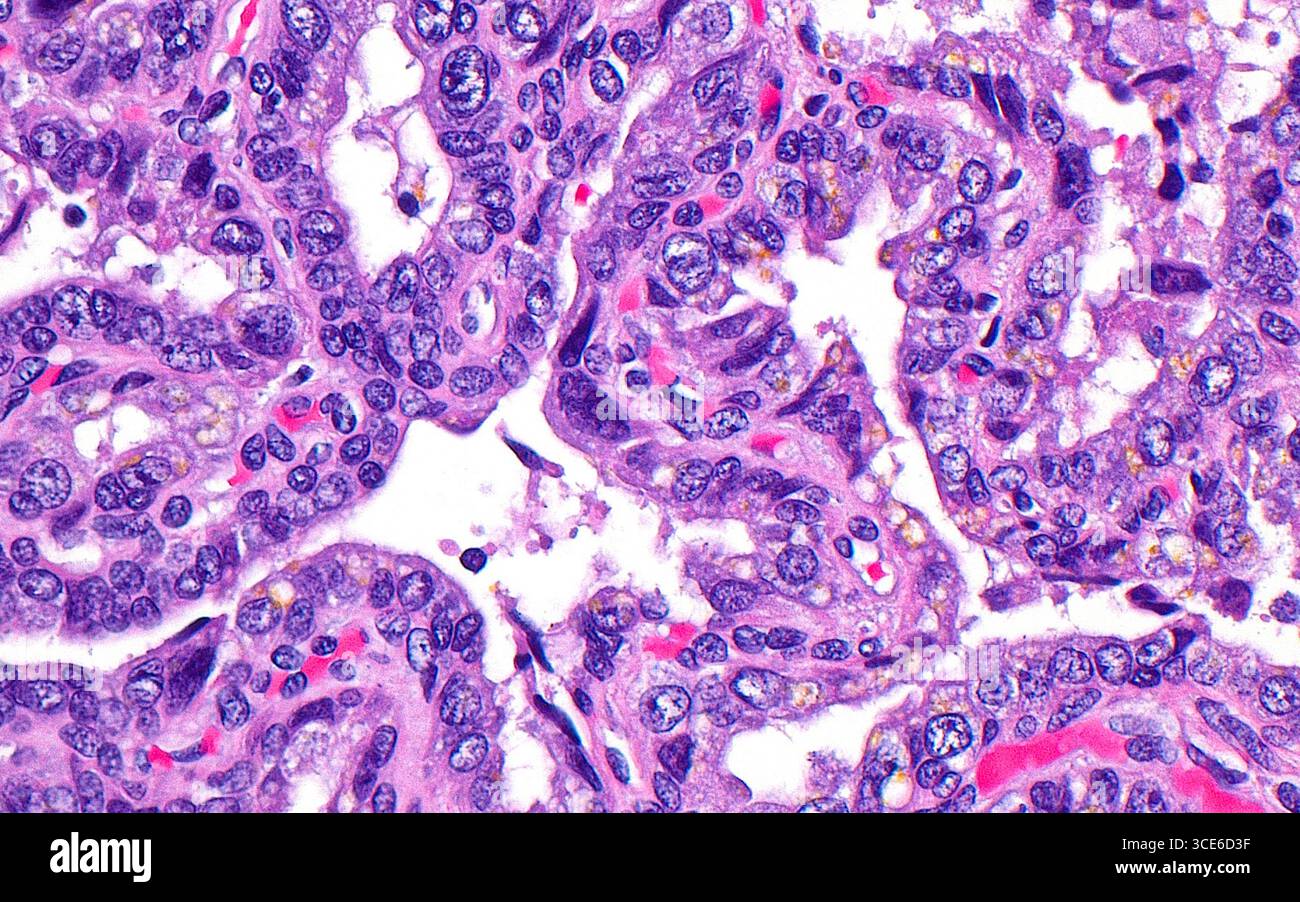 Micrographie à la lumière de l'épithélium vésiculaire séminal. L'épithélium est constitué des cellules de revêtement dans les glandes de la vésicule séminale. L'épithélium des vésicules séminales se caractérise par des cellules rondes et parfois agrandies (structures bleues rondes), ainsi que par un pigment de lipofuscine (jaune). La vésicule séminale sécrète des substances dans sa lumière (zones blanches de l'image). Coupe de tissu colorée à l'hématoxyline et à l'éosine. Grossissement : 400x lorsqu'il est imprimé à 10cm. Banque D'Images
