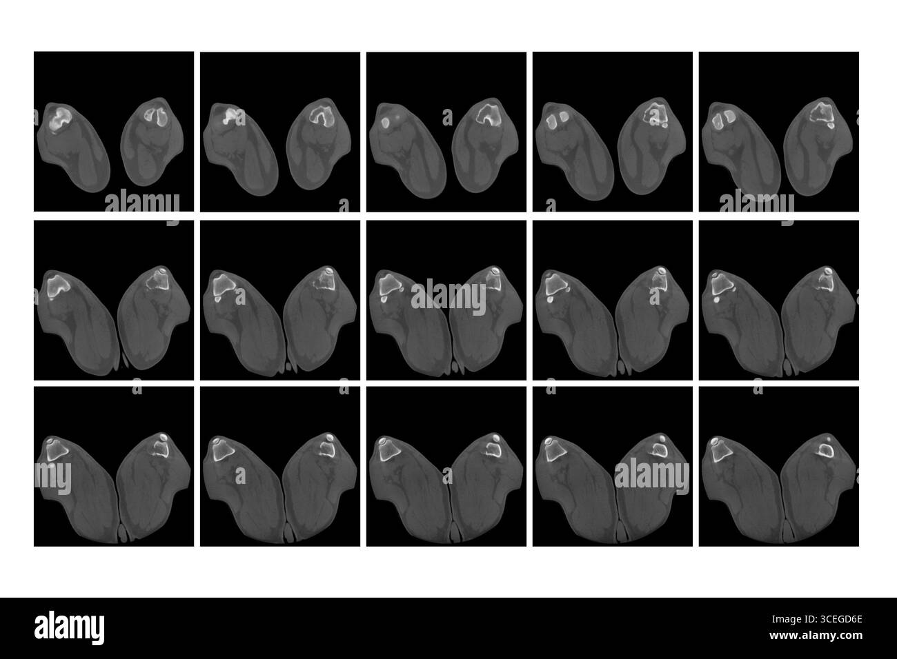 Tomodensitométrie séquentielle d'une articulation de jambe arrière de chien révélant une tumeur osseuse. Imagerie vétérinaire du diagnostic des ostéosarcomes de l'os canin Banque D'Images