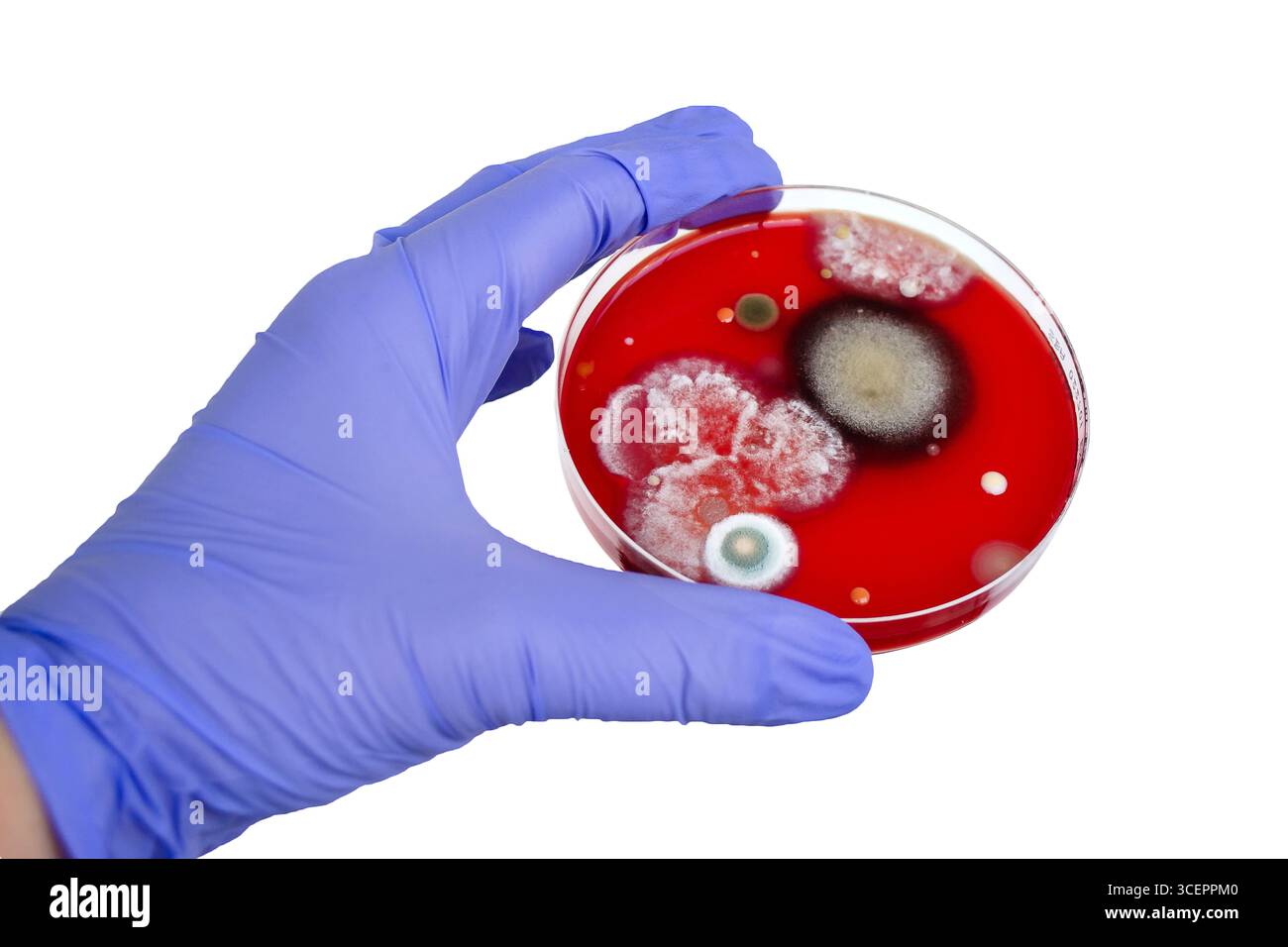 Colonies de champignons de moisissure cultivées à partir de l'air intérieur sur gélose Blood Sheep, photographie montrant la diversité microbienne et la contamination de l'air. Banque D'Images