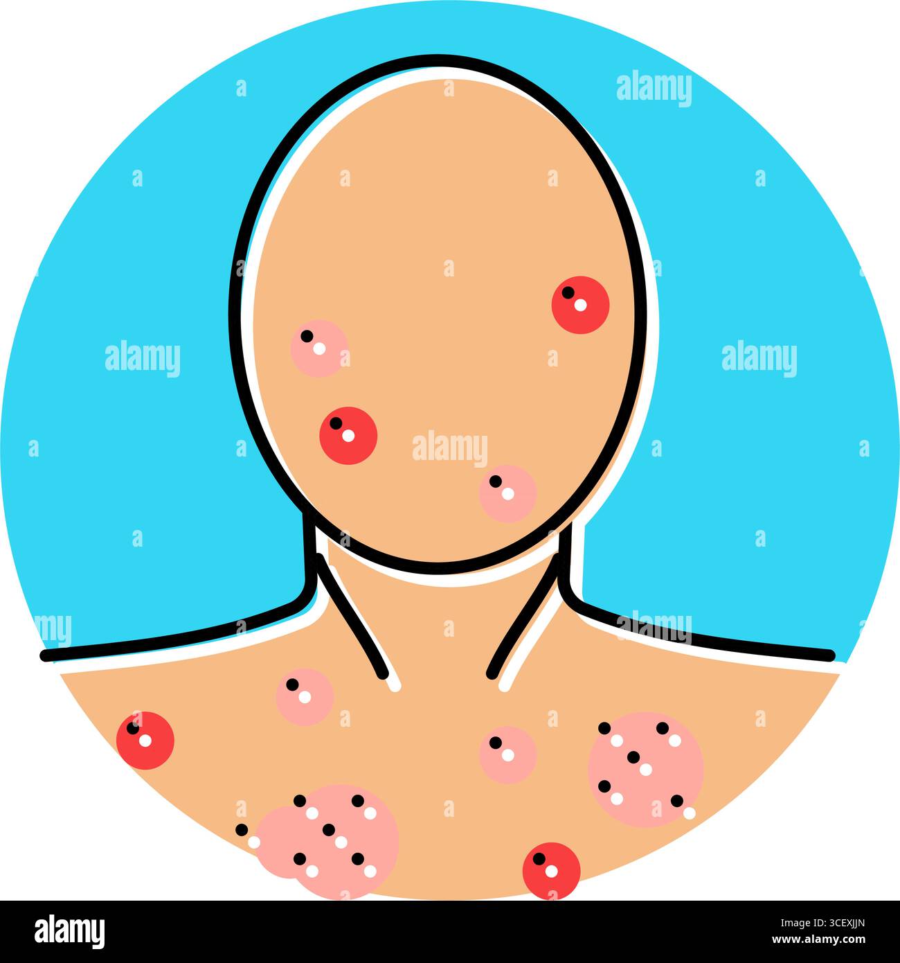 illustration vectorielle d'icône de couleur de puberté d'acné adolescence Illustration de Vecteur