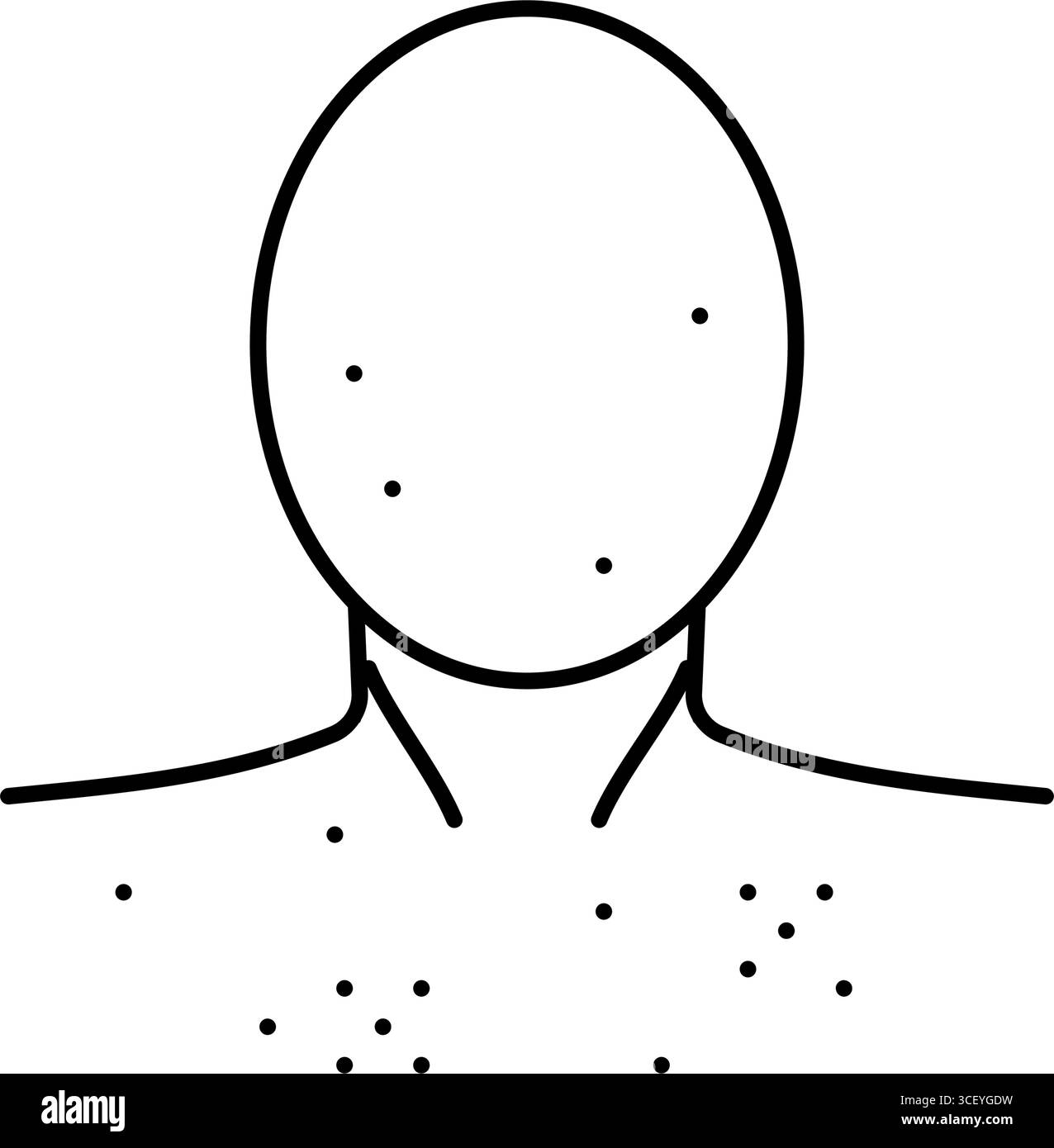 illustration vectorielle d'icône de ligne de puberté d'acné adolescence Illustration de Vecteur