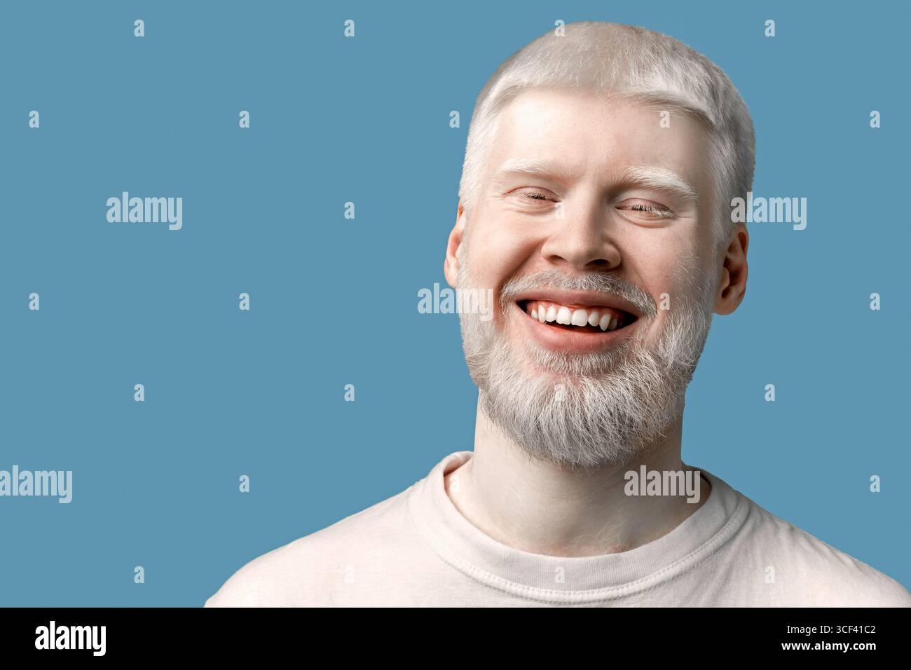 Portrait d'homme albinos barbu heureux avec la peau pâle et les cheveux blancs souriant à la caméra sur fond turquoise Banque D'Images